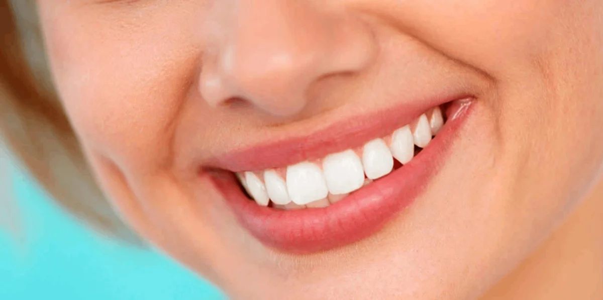 Dental Centro Blanqueamiento Dental