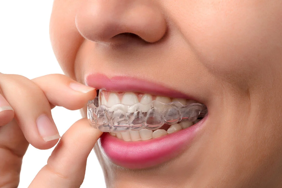 Ortodoncia Dental Centro